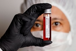 L’OMS appelle à un moratoire sur les doses de rappel jusqu’à la fin septembre 