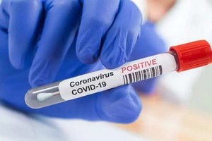 Coronavirus : 3493 cas actifs en Mauritanie dont 1895 à Nouakchott