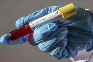 Covid-19 : recul des cas contaminés dans les hôpitaux mauritaniens